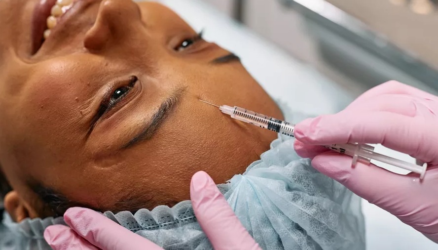 Harmonização Orofacial Botox em Juazeiro do Norte Crato Barbalha Dra Lorena Mendes Martins Dentista Odontóloga Procedimentos Estáticos